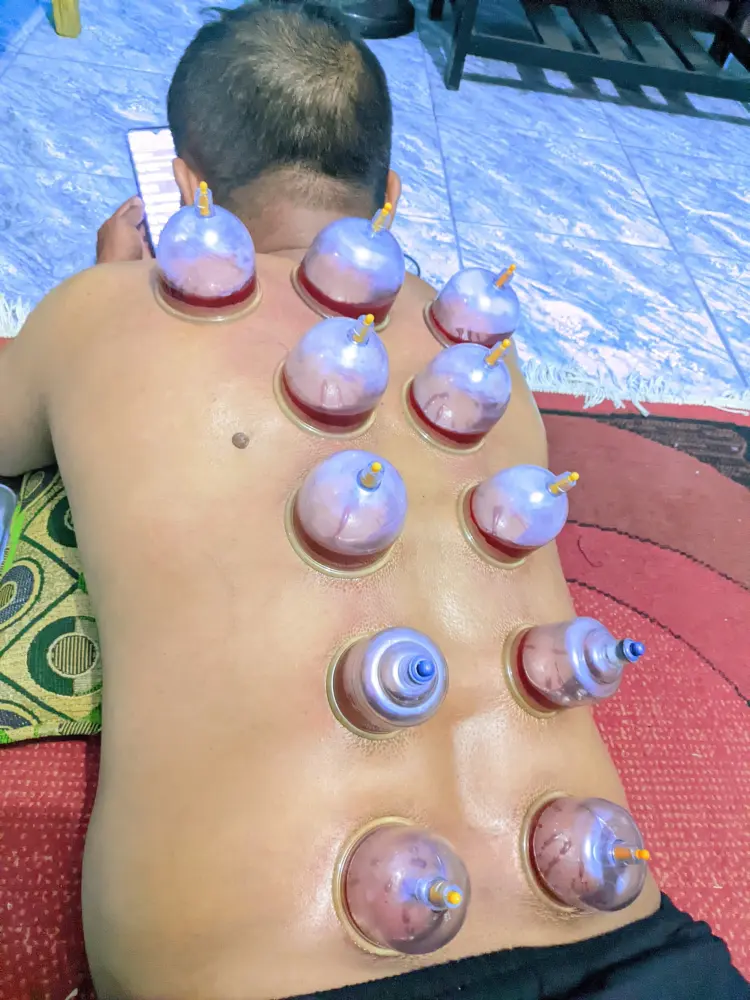 Rumah Terapi Bekam Pijat Griya Sehat Indonesia 1