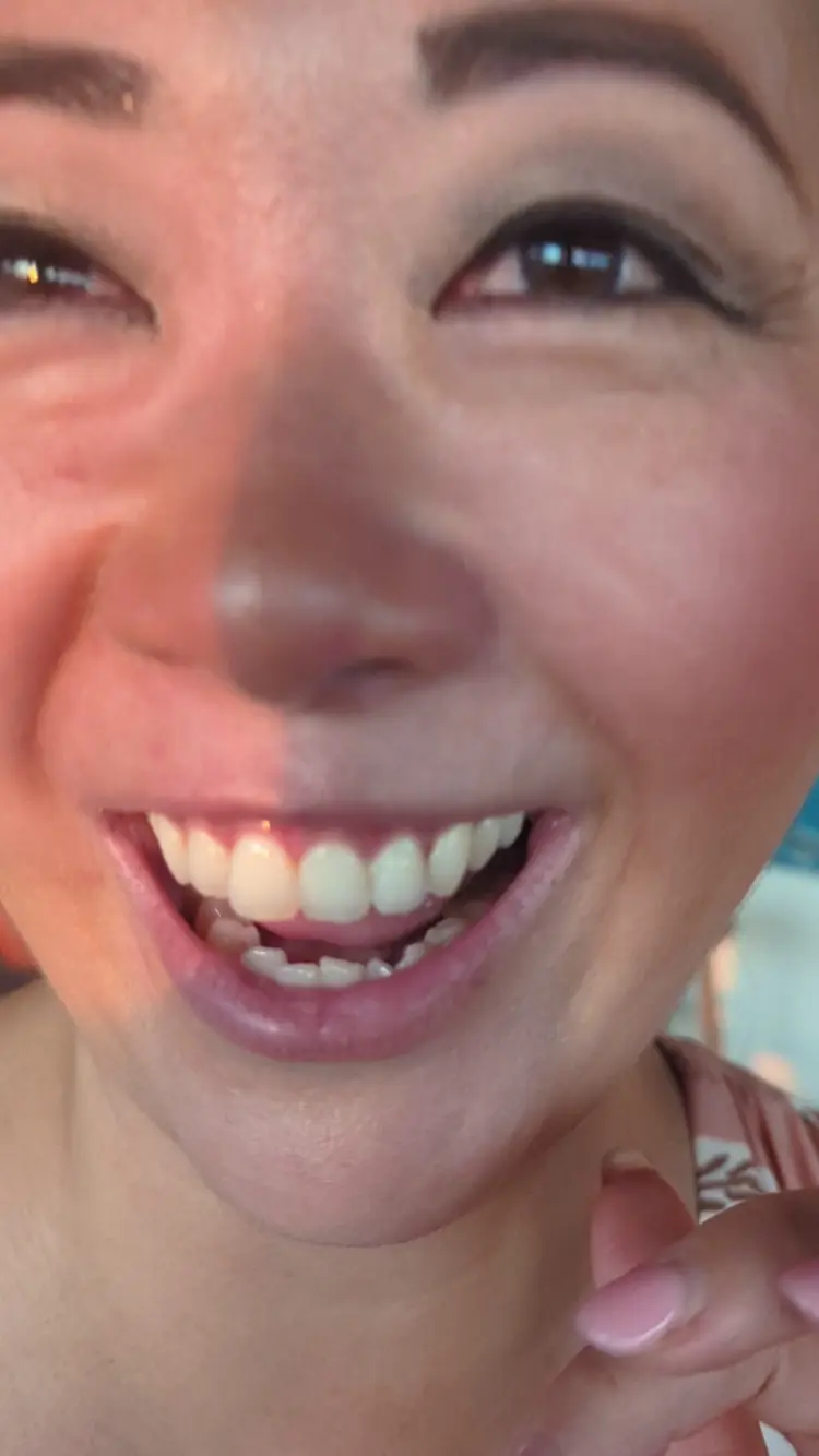 The Lawn Canggu Beach Club 3